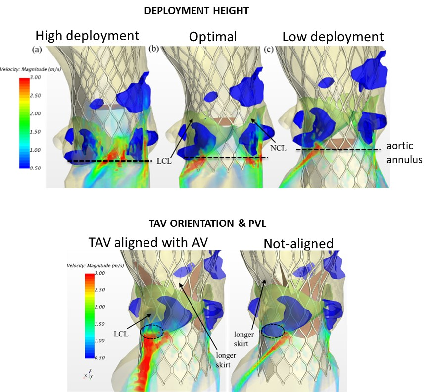 Deployment height optimization