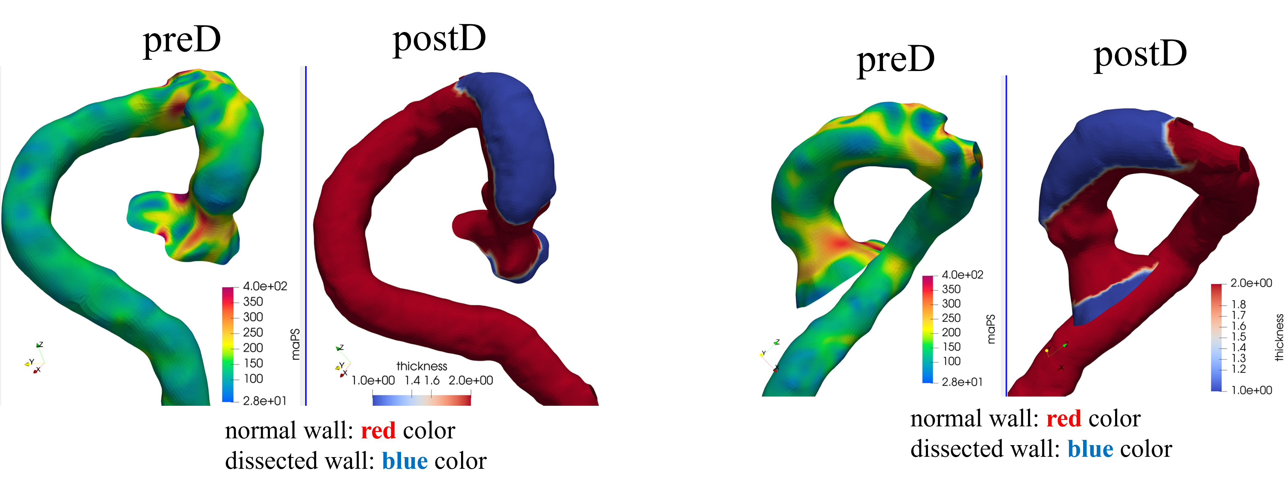 Pre/post analysis — Case 1