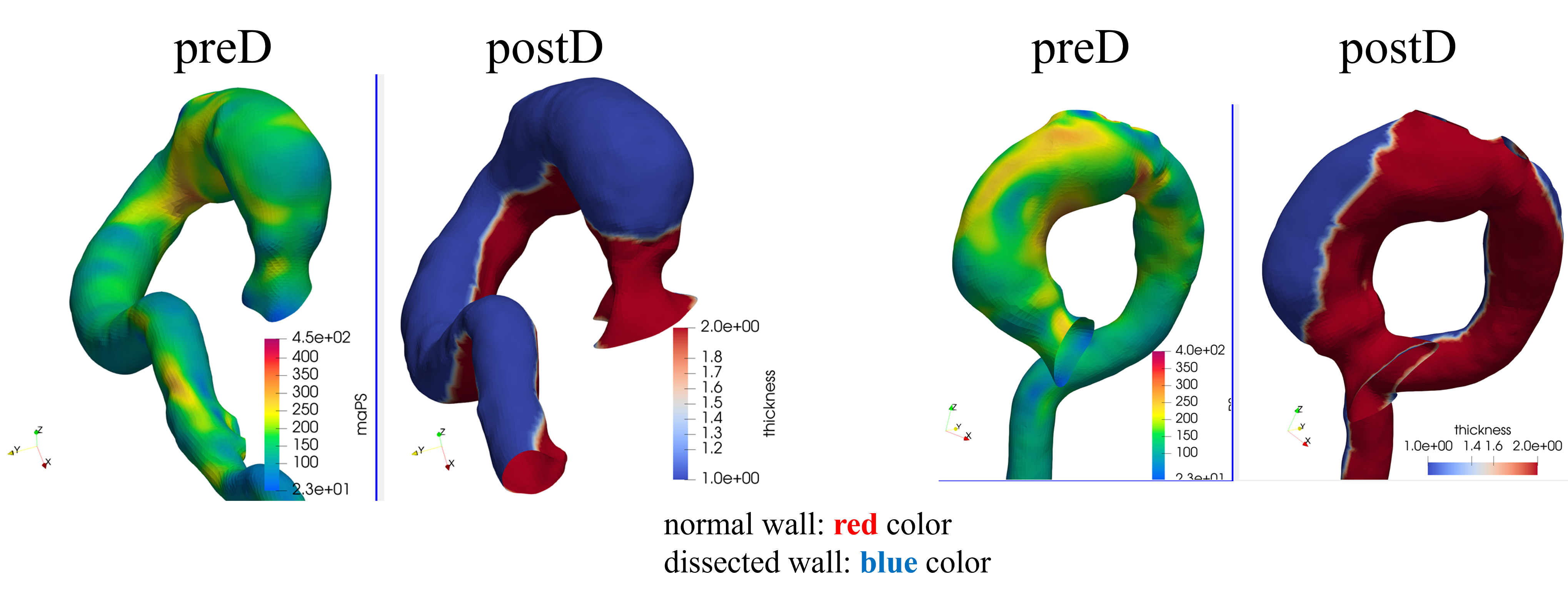 Pre/post analysis — Case 3