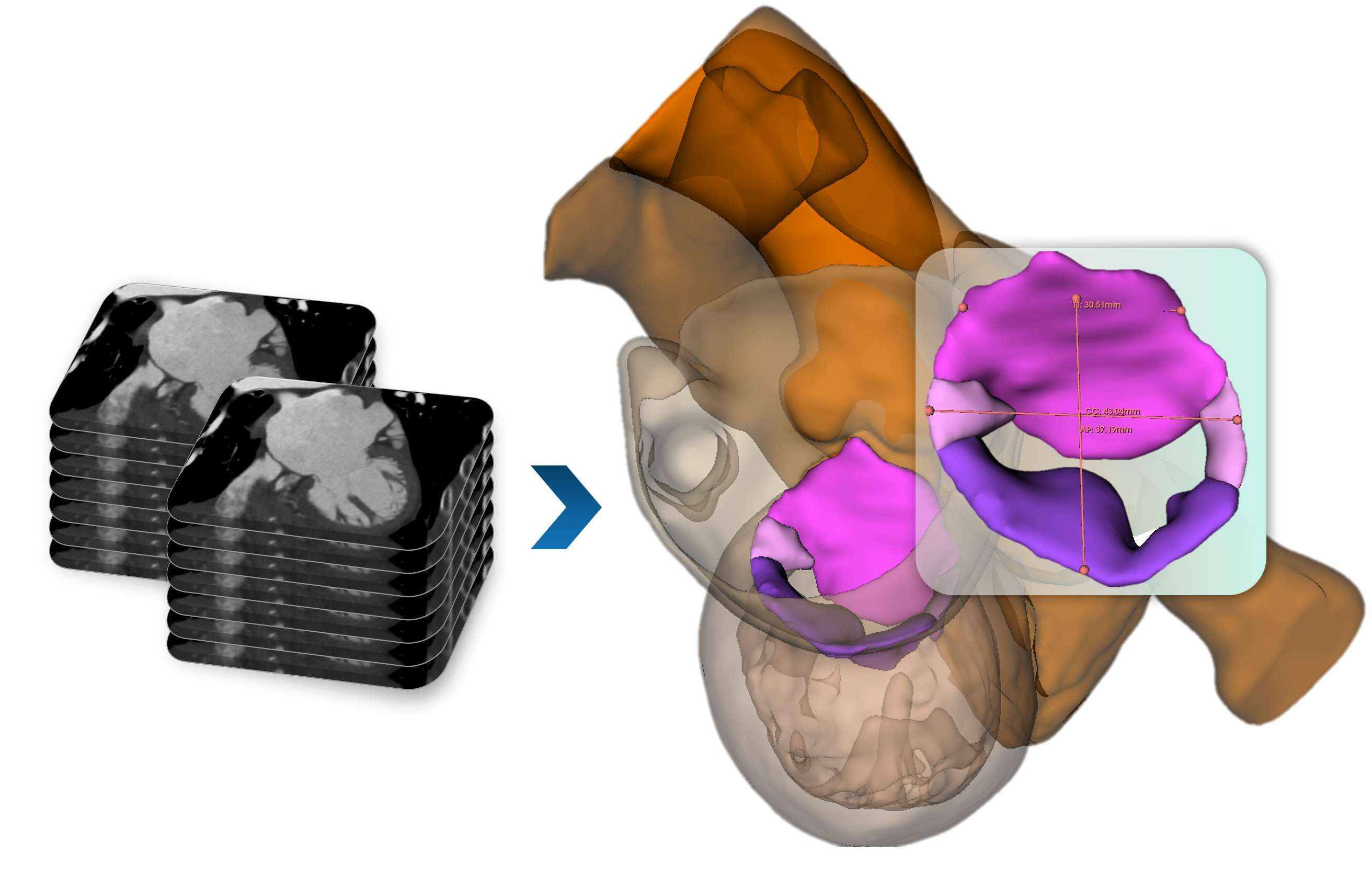 3D Anatomy Reconstruction