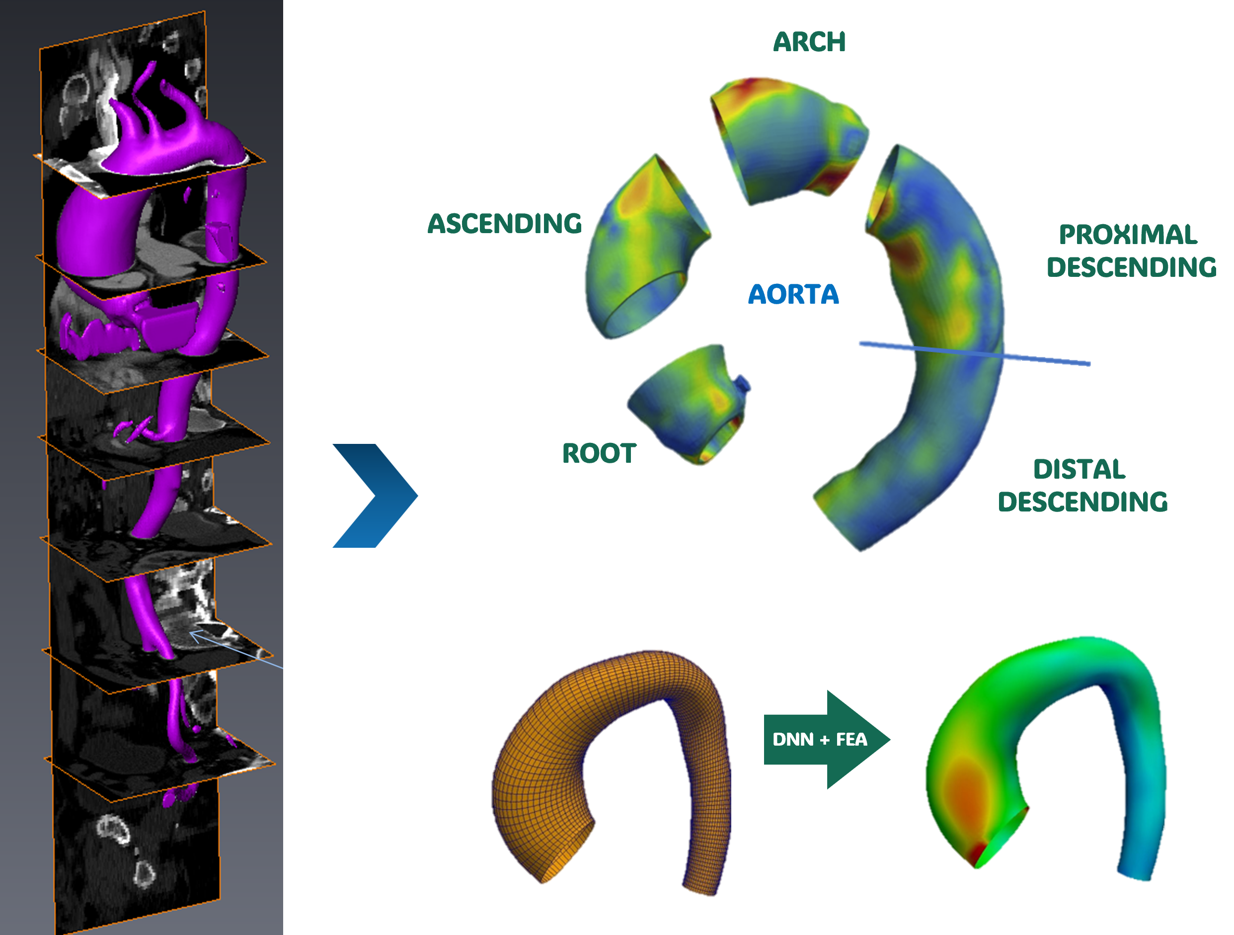TAA Rupture Risk Analysis
